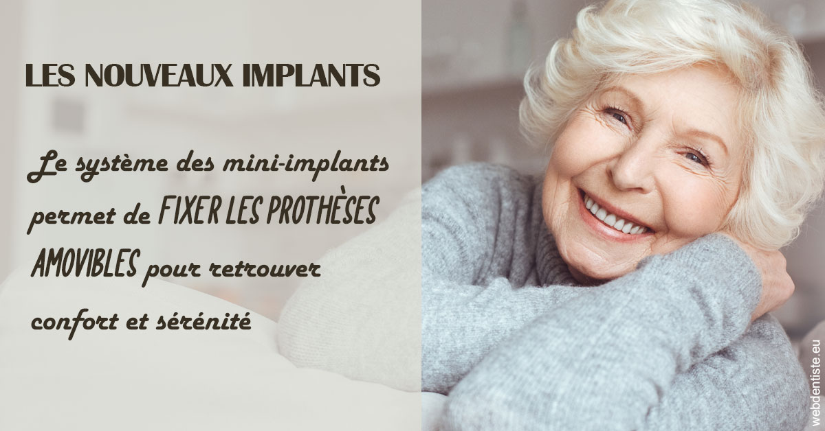 https://selarl-gelos.chirurgiens-dentistes.fr/Les nouveaux implants 1