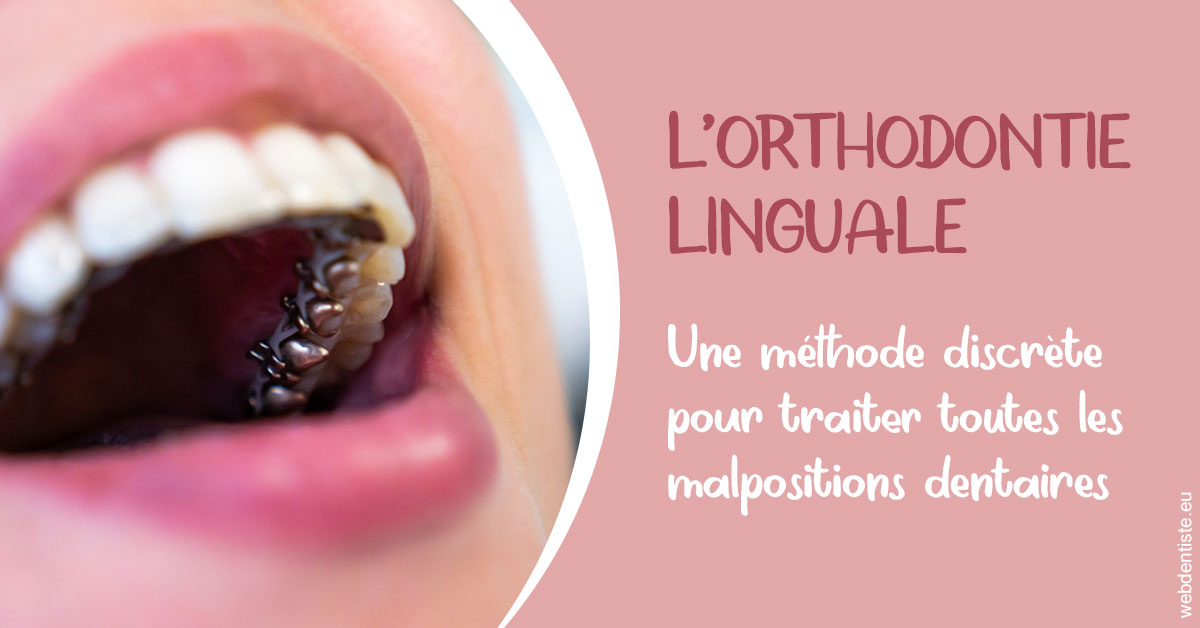 https://selarl-gelos.chirurgiens-dentistes.fr/L'orthodontie linguale 2