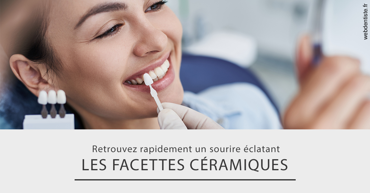 https://selarl-gelos.chirurgiens-dentistes.fr/Les facettes céramiques 2