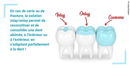 https://selarl-gelos.chirurgiens-dentistes.fr/L'INLAY ou l'ONLAY