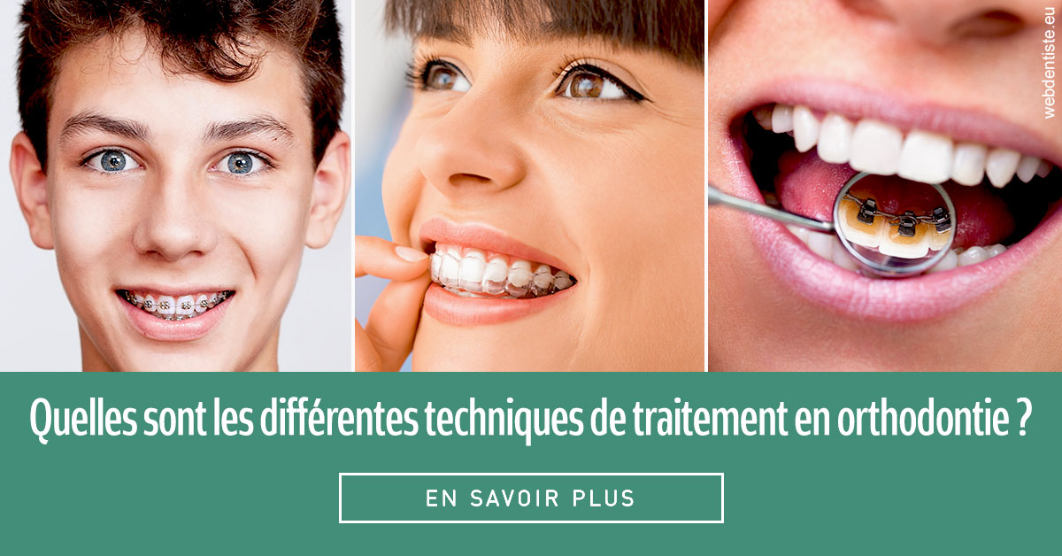 https://selarl-gelos.chirurgiens-dentistes.fr/Les différentes techniques de traitement 2