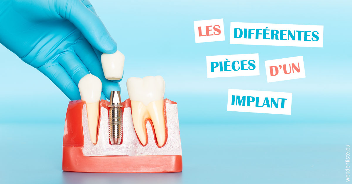 https://selarl-gelos.chirurgiens-dentistes.fr/Les différentes pièces d’un implant 2