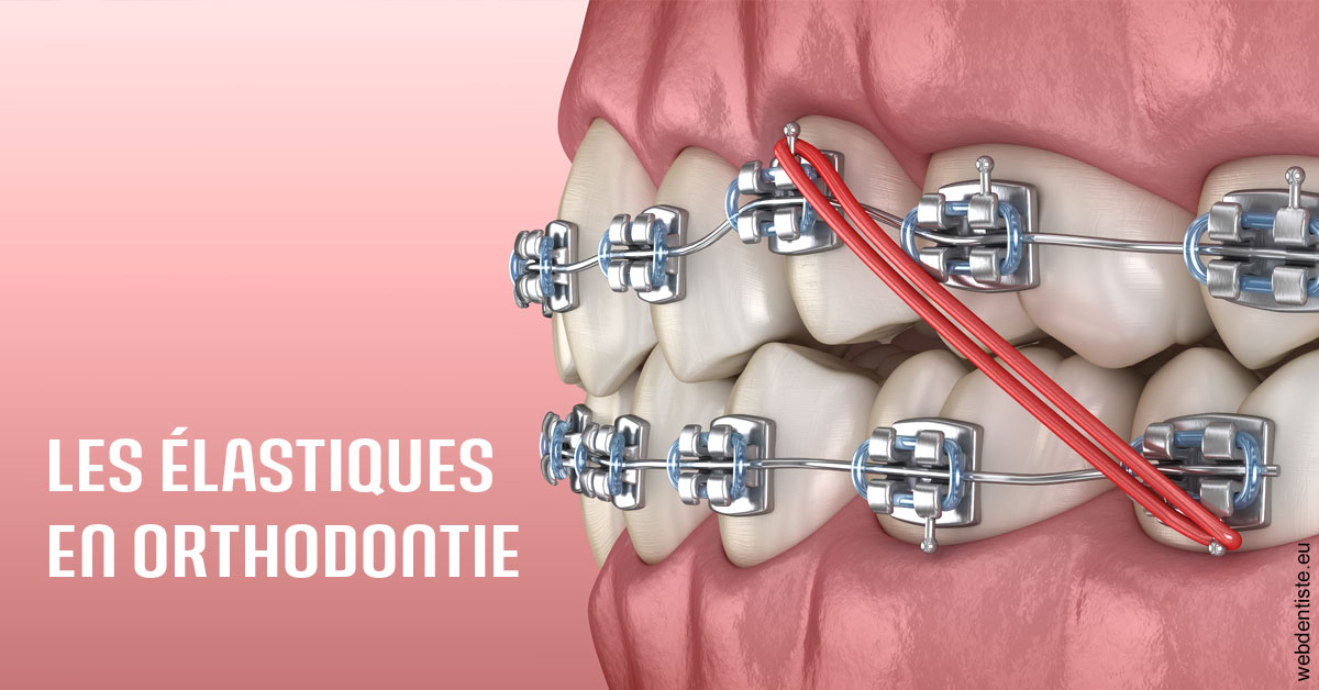https://selarl-gelos.chirurgiens-dentistes.fr/Elastiques orthodontie 2