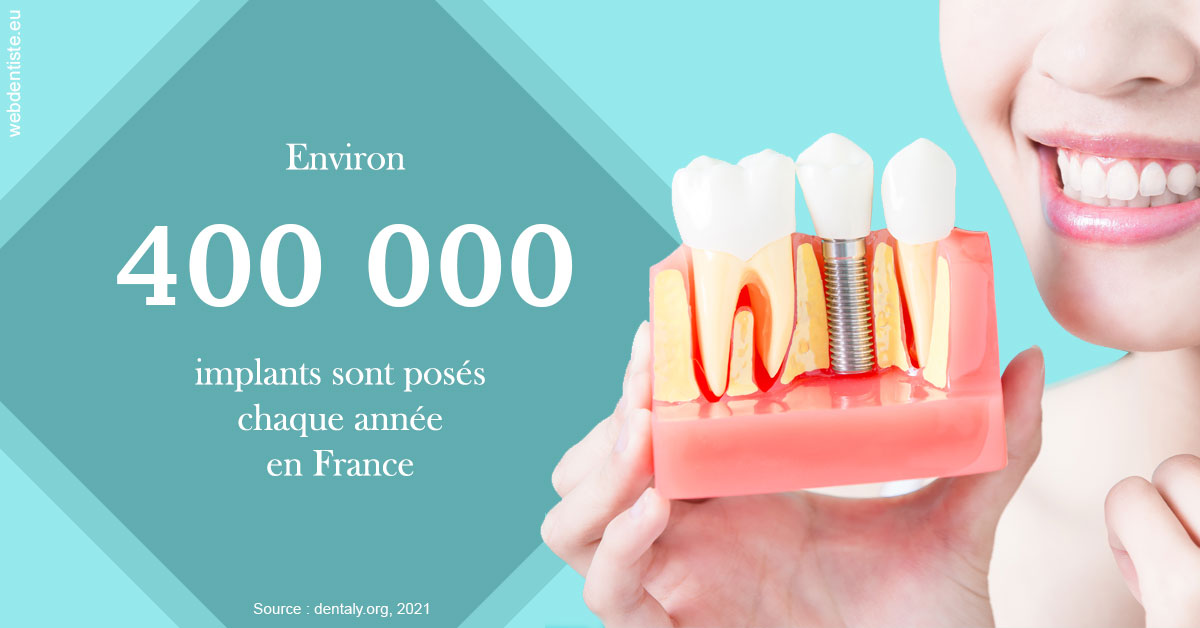 https://selarl-gelos.chirurgiens-dentistes.fr/Pose d'implants en France 2
